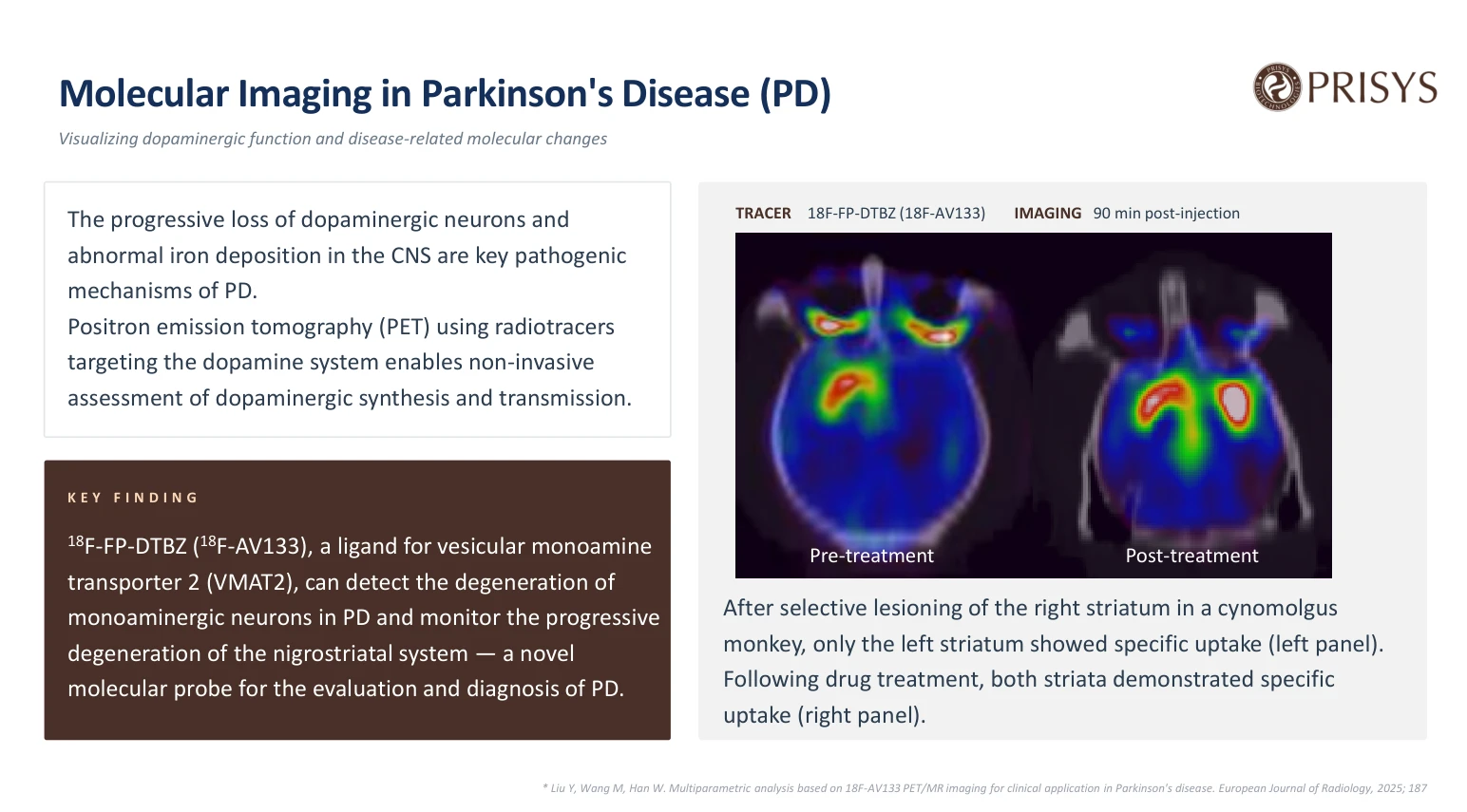 Molecular Imaging in Parkinson's Disease (PD) Visualizing dopaminergic function and disease-related molecular changes Molecular Imaging in Parkinson's Disease (PD) Visualizing dopaminergic function and disease-related molecular changes